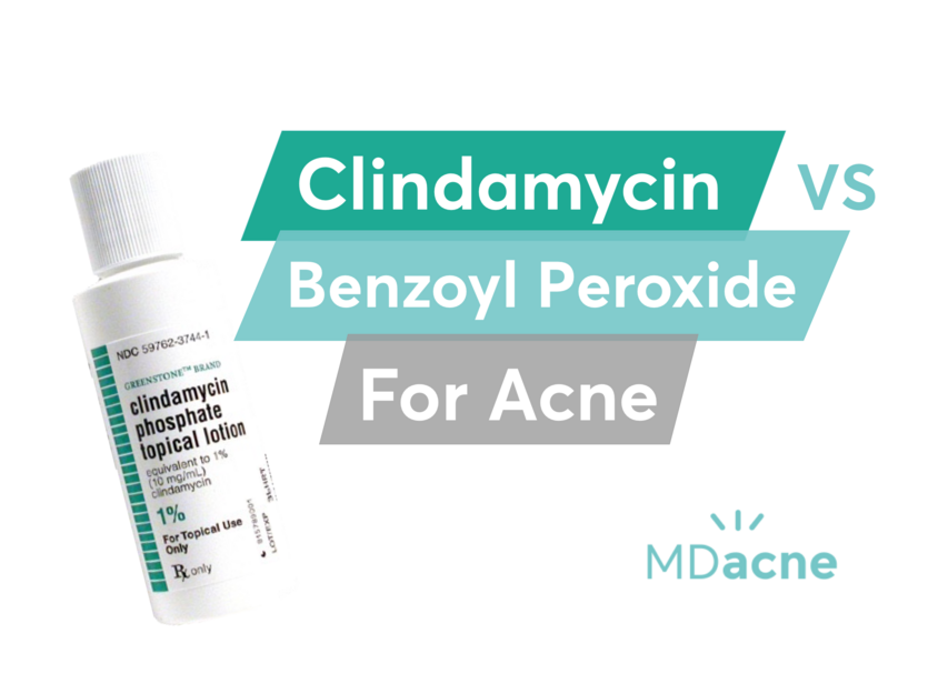 A comparison of Clindamycin lotion versus benzoyl peroxide for the treatment of acne