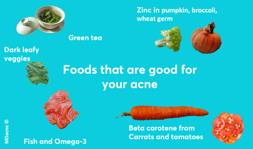 Foods that are good for acne