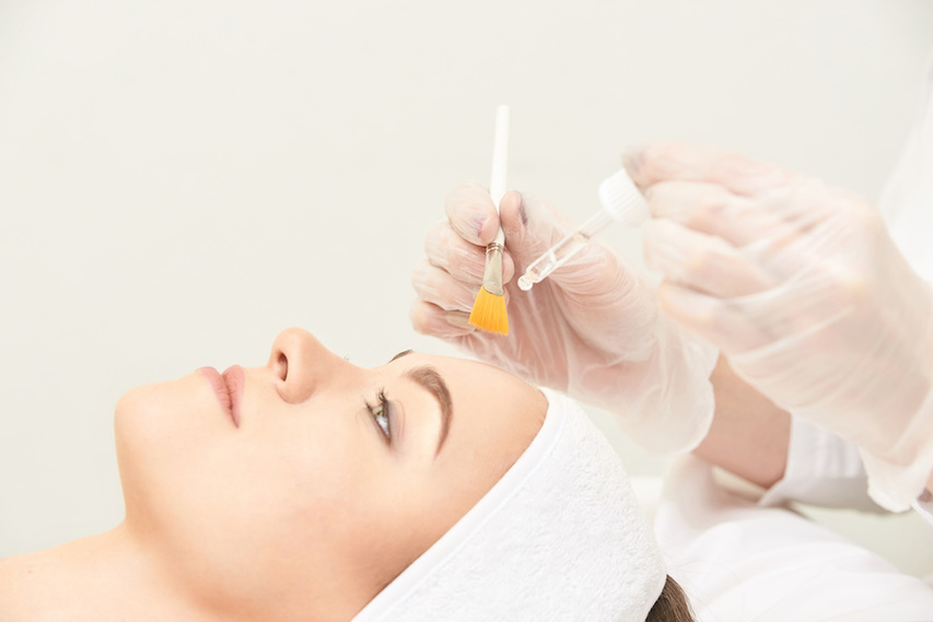 Dermatologist conducting chemical peel on woman with acne scars