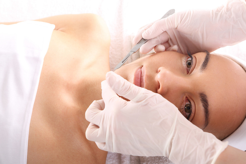 BEST Laser Treatment For Acne Scars In Hollywood Fl Laser,, 47% OFF