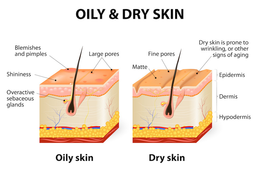 Oily vs. dry skin medical diagram