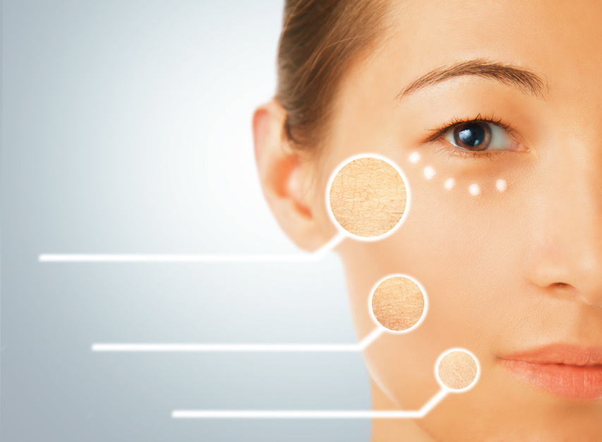 Up close look at dry skin