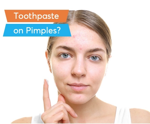 a women applying toothpaste on her pimples