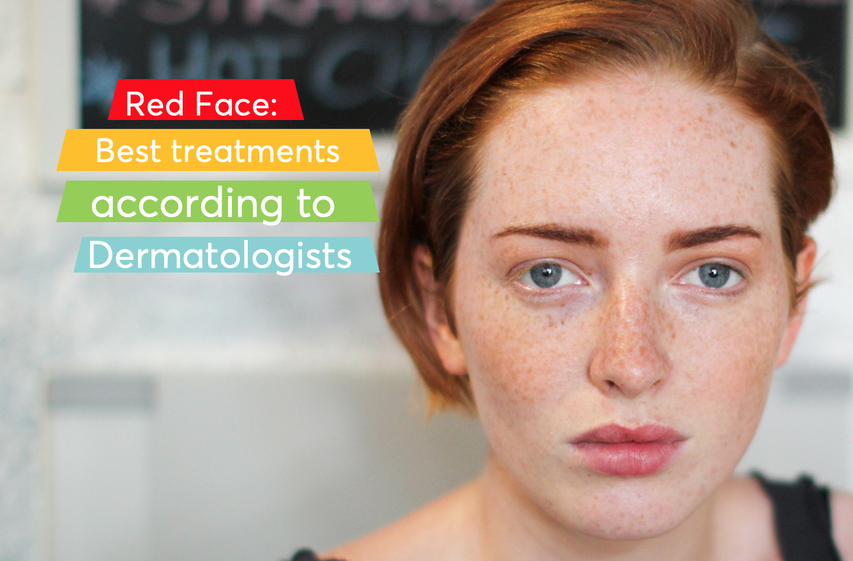 Red face causes and treatments according to dermatologists | MDacne