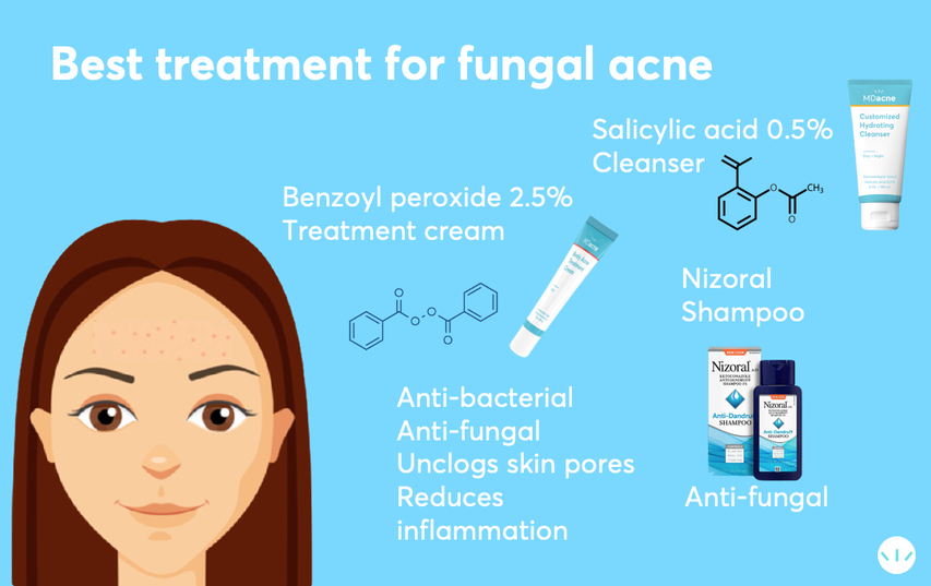 Best treeatmnt for fungal acne infographic