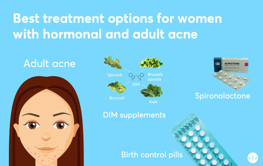 Hormonal acne oral treatment infographic