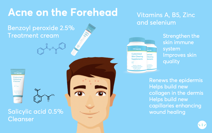 Forehead acne treatment infographic 