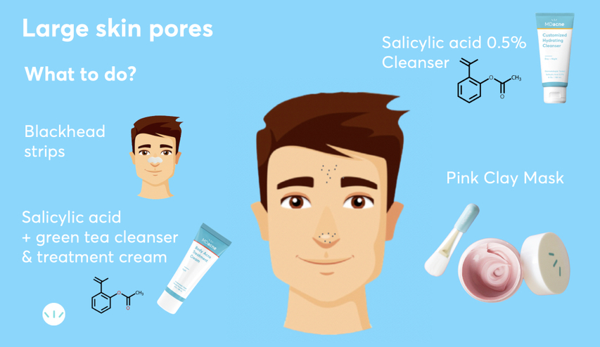 Best treatments for large pores infographic