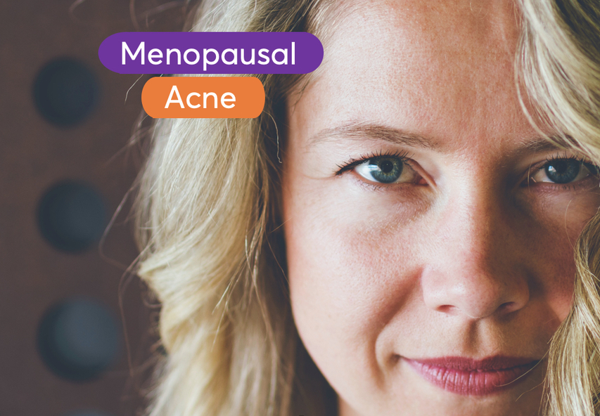 Menopausal Acne- Best Treatments According to Dermatologists  MDacne