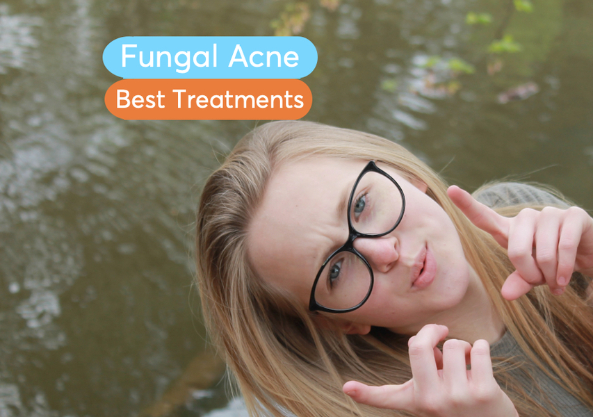 Fungal Acne Causes And Treatments Mdacne Fungal Acne Causes And Treatments Mdacne