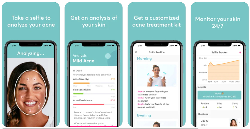 MDacne app allowing immediate acne analysis 