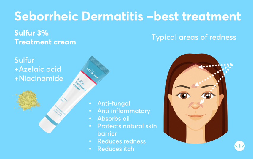 Best treatment for seborrheic dermatitis sulfur