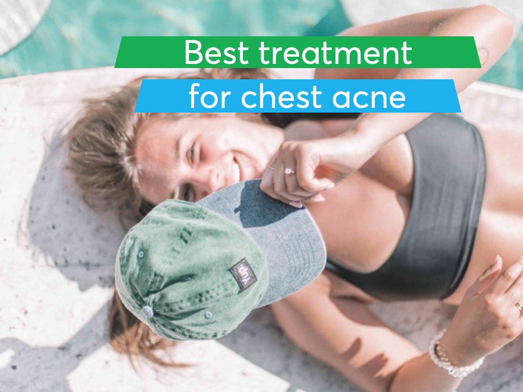 Best treatments for chest acne - affordable and efficient | MDacne