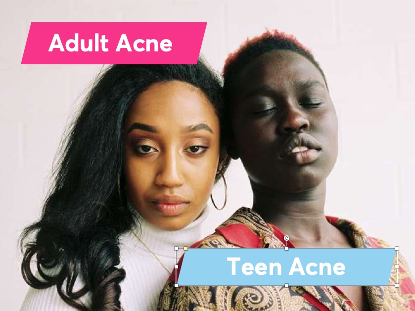 Teens Vs Black