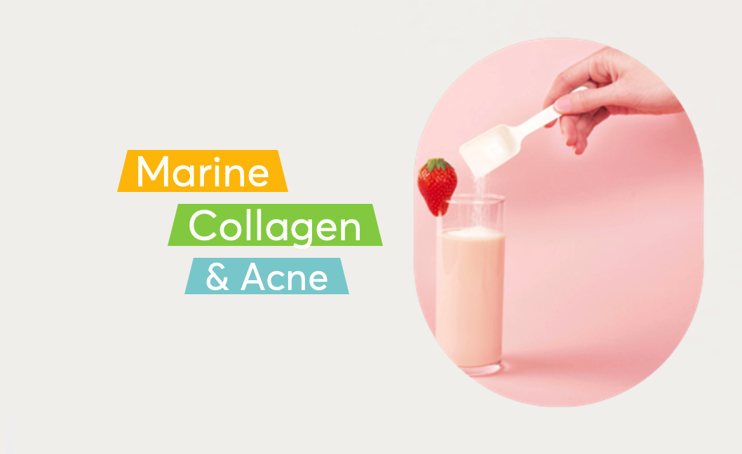 Benefits of Marine Collagen Peptides for People with Acne MDacne